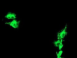 KCNJ3 Mouse anti-Human, Clone: OTI1D3, lyophilized, TrueMAB 100 &mu;g;