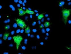 KCNJ3 Monoclonal Antibody (OTI1B1), TrueMAB , OriGene 100 &mu;L; Unconjugated:Antibodies,