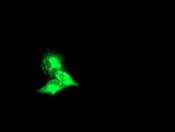 KCNJ3 Monoclonal Antibody (OTI1G2), TrueMAB , OriGene 30 &mu;L; Unconjugated:Antibodies,