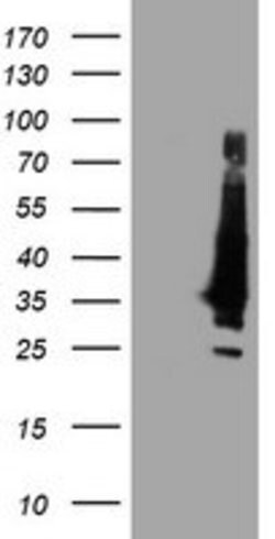 KCNJ3 Mouse anti-Human, Clone: OTI2F2, lyophilized, TrueMAB 100 &mu;g;
