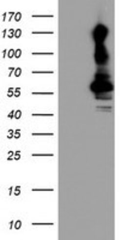 KCNJ3 Mouse anti-Canine, Human, Mouse, Rat, Clone: OTI1C5, lyophilized,