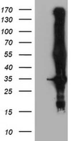 KCNJ3 Monoclonal Antibody (OTI1D3), TrueMAB , OriGene 100 &mu;L; Unconjugated:Antibodies,