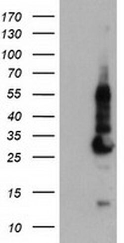 KCNJ3 Monoclonal Antibody (OTI1B1), TrueMAB , OriGene 100 &mu;L; Unconjugated:Antibodies,