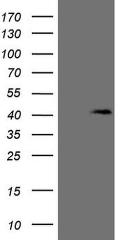 KCTD13 Monoclonal Antibody (OTI1A4), TrueMAB , OriGene 100 &mu;L; Unconjugated:Antibodies,