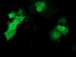 KCTD14 Monoclonal Antibody (OTI2A6), TrueMAB , OriGene 100 &mu;L; Unconjugated:Antibodies,