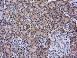 KCTD14 Monoclonal Antibody (OTI3A4), TrueMAB , OriGene 100 &mu;L; Unconjugated:Antibodies,
