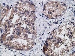 KCTD14 Monoclonal Antibody (OTI1D11), TrueMAB , OriGene 100 &mu;L; Unconjugated:Antibodies,
