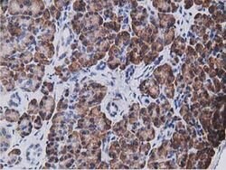 KCTD14 Monoclonal Antibody (OTI1D11), TrueMAB , OriGene 100 &mu;L; Unconjugated:Antibodies,