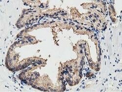 KCTD14 Monoclonal Antibody (OTI1D11), TrueMAB , OriGene 100 &mu;L; Unconjugated:Antibodies,