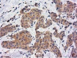 KCTD14 Monoclonal Antibody (OTI1D11), TrueMAB , OriGene 100 &mu;L; Unconjugated:Antibodies,