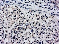 KCTD14 Monoclonal Antibody (OTI1D11), TrueMAB , OriGene 100 &mu;L; Unconjugated:Antibodies,