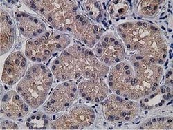 KCTD14 Monoclonal Antibody (OTI1D11), TrueMAB , OriGene 100 &mu;L; Unconjugated:Antibodies,