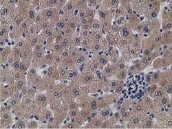 KCTD14 Monoclonal Antibody (OTI1D11), TrueMAB , OriGene 100 &mu;L; Unconjugated:Antibodies,