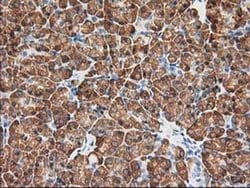 KCTD14 Monoclonal Antibody (OTI2A6), TrueMAB , OriGene 100 &mu;L; Unconjugated:Antibodies,