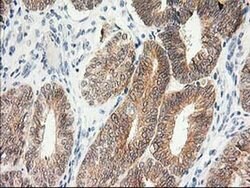 KCTD14 Monoclonal Antibody (OTI2A6), TrueMAB , OriGene 100 &mu;L; Unconjugated:Antibodies,