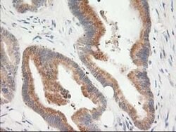 KCTD14 Monoclonal Antibody (OTI2A6), TrueMAB , OriGene 100 &mu;L; Unconjugated:Antibodies,