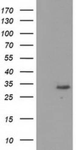 KCTD14 Monoclonal Antibody (OTI3A4), TrueMAB , OriGene:Antibodies:Primary