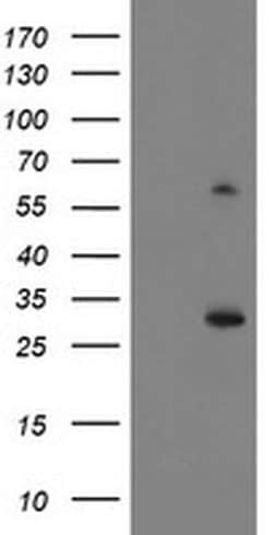 KCTD14 Monoclonal Antibody (OTI1A11), TrueMAB , OriGene 100 &mu;L; Unconjugated:Antibodies,