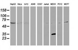 KCTD14 Monoclonal Antibody (OTI1A11), TrueMAB , OriGene 100 &mu;L; Unconjugated:Antibodies,
