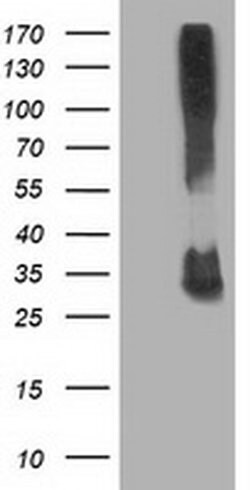 KCTD14 Monoclonal Antibody (OTI2A6), TrueMAB , OriGene:Antibodies:Primary