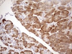 KCTD9 Monoclonal Antibody (OTI1B9), TrueMAB , OriGene 100 &mu;L; Unconjugated:Antibodies,