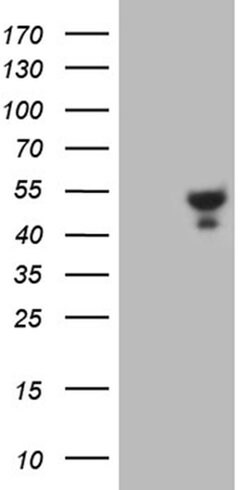 KCTD9 Monoclonal Antibody (OTI5F11), TrueMAB , OriGene 100 &mu;L; Unconjugated:Antibodies,