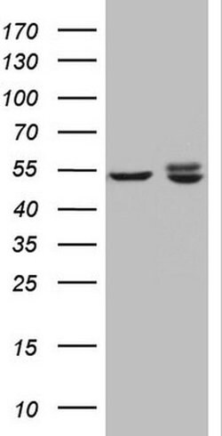 KCTD9 Monoclonal Antibody (OTI1D10), TrueMAB , OriGene:Antibodies:Primary