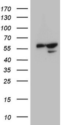 KCTD9 Monoclonal Antibody (OTI1B9), TrueMAB , OriGene 100 &mu;L; Unconjugated:Antibodies,