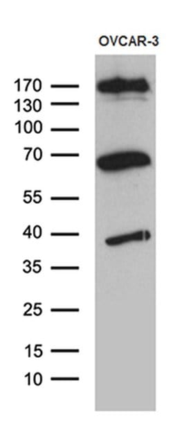 KDELC2 Monoclonal Antibody (OTI5G2), TrueMAB , OriGene 100 &mu;L; Unconjugated:Antibodies,