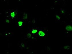 KDM4C Mouse anti-Human, Clone: OTI4B1, lyophilized, TrueMAB 100 &mu;g;
