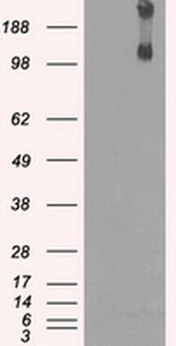 KDM4C Mouse anti-Human, Clone: OTI5B9, liquid, TrueMAB 100 &mu;L; Unconjugated:Antibodies,