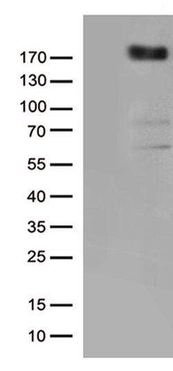 KDR Monoclonal Antibody (OTI2A1), TrueMAB , OriGene:Antibodies:Primary