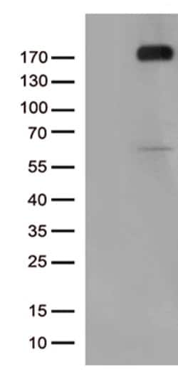 KDR Mouse anti-Human, Clone: OTI12C1, lyophilized, TrueMAB 100 &mu;g; Unconjugated:Antibodies,