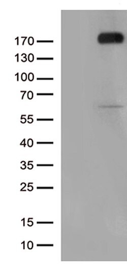 KDR Monoclonal Antibody (OTI12C1), TrueMAB , OriGene:Antibodies:Primary