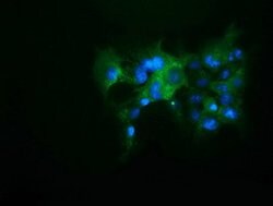 KEAP1 Mouse anti-Human, Clone: OTI1G2, lyophilized, TrueMAB 100 &mu;g;