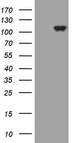 KEL Monoclonal Antibody (OTI8E1), TrueMAB , OriGene 100 &mu;L; Unconjugated:Antibodies,
