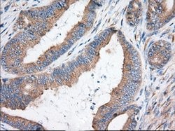 KHK Mouse anti-Human, Clone: OTI3C4, lyophilized, TrueMAB 100 &mu;g; Unconjugated:Antibodies,