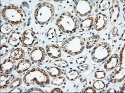 KHK Monoclonal Antibody (OTI4E9), TrueMAB , OriGene 30 &mu;L; Unconjugated:Antibodies,