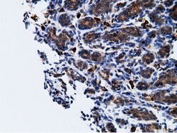 KHK Mouse anti-Human, Clone: OTI3D1, lyophilized, TrueMAB 100 &mu;g; Unconjugated:Antibodies,