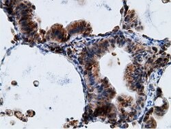 KHK Mouse anti-Human, Clone: OTI3D1, lyophilized, TrueMAB 100 &mu;g; Unconjugated:Antibodies,