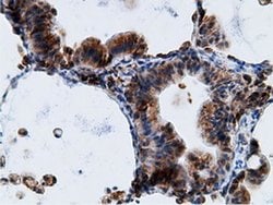 KHK Mouse anti-Human, Clone: OTI3D1, liquid, TrueMAB 100 &mu;L; Unconjugated:Antibodies,