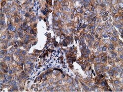 KHK Mouse anti-Human, Clone: OTI3D1, lyophilized, TrueMAB 100 &mu;g; Unconjugated:Antibodies,