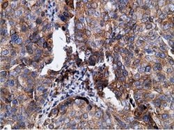 KHK Mouse anti-Human, Clone: OTI3D1, liquid, TrueMAB 100 &mu;L; Unconjugated:Antibodies,