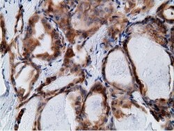 KHK Mouse anti-Human, Clone: OTI3D1, lyophilized, TrueMAB 100 &mu;g; Unconjugated:Antibodies,