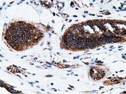 KHK Mouse anti-Human, Clone: OTI3D1, lyophilized, TrueMAB 100 &mu;g; Unconjugated:Antibodies,