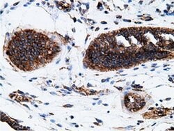 KHK Mouse anti-Human, Clone: OTI3D1, liquid, TrueMAB 100 &mu;L; Unconjugated:Antibodies,