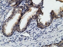 KHK Mouse anti-Human, Clone: OTI3D1, lyophilized, TrueMAB 100 &mu;g; Unconjugated:Antibodies,
