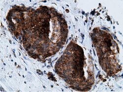 KHK Mouse anti-Human, Clone: OTI3D1, lyophilized, TrueMAB 100 &mu;g; Unconjugated:Antibodies,