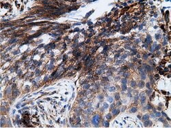 KHK Mouse anti-Human, Clone: OTI3D1, lyophilized, TrueMAB 100 &mu;g; Unconjugated:Antibodies,