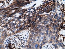 KHK Mouse anti-Human, Clone: OTI3D1, liquid, TrueMAB 100 &mu;L; Unconjugated:Antibodies,